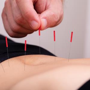 Acupuncture helps ease postoperative ileus after GI surgery