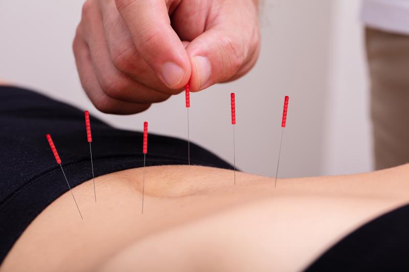 Acupuncture beneficial in chronic sciatica