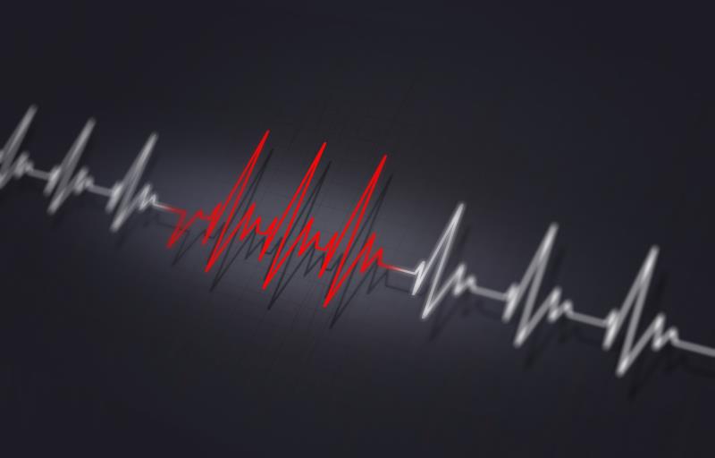Rapid IV sotalol loading feasible, safe for AF patients