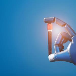 AI helps spot HCC sooner