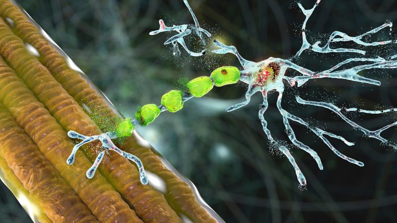 Intravenous (IV) edaravone seems to continue to provide hope for individuals with <a href="https://specialty.mims.com/amyotro