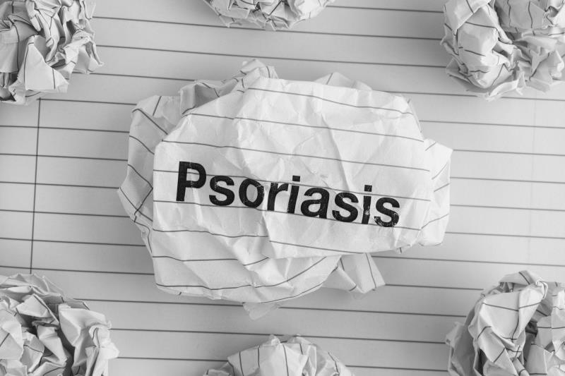Vitamin D supplementation exerts no effect on psoriasis severity in vitamin D-deficient individuals
