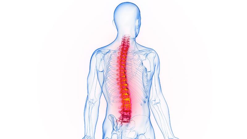 Radiographic progression minimal even after long-term bimekizumab use in r-axSpA patients