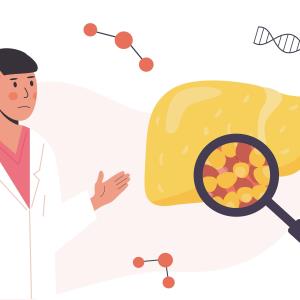 Blood-based biomarker panel aids noninvasive diagnosis of MASH