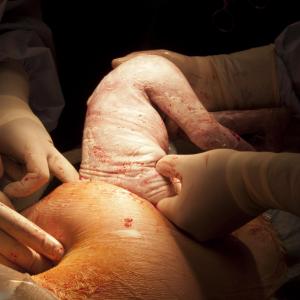 Junior residents need more exposure to manage obstetric airway