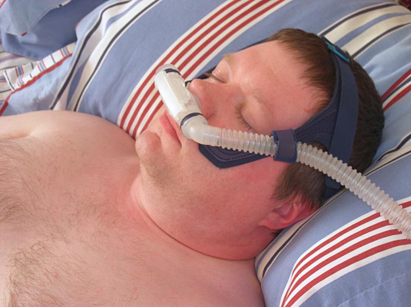 Long-term CPAP use confers benefits for diabetes in sleep apnoea patients