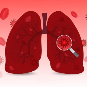 Death, adverse health outcomes higher for COVID-19 than influenza after hospital admission