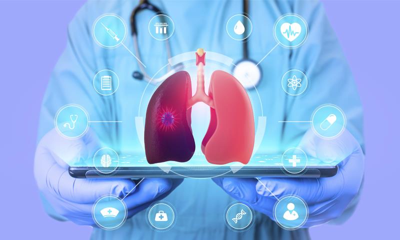 Does lung biopsy worsen lung function, survival in IPF patients?