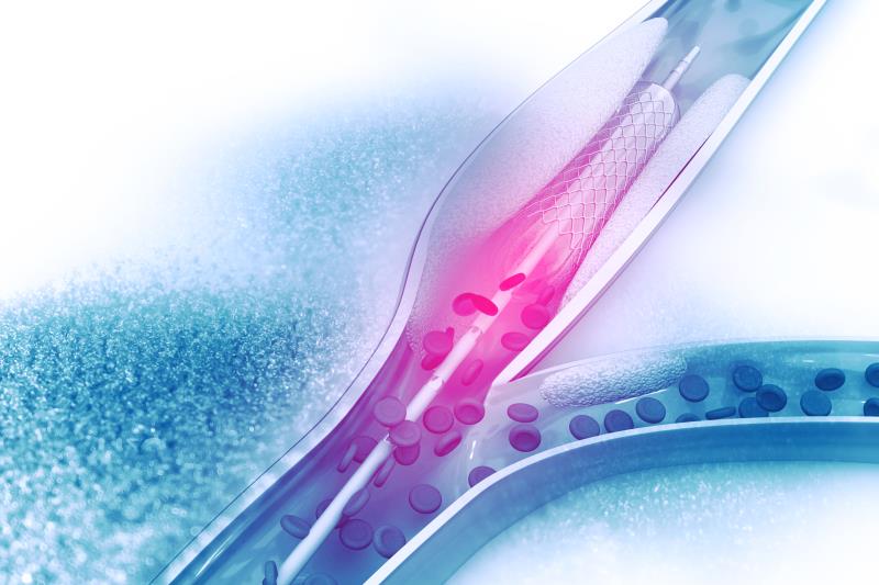 Metallic better than polymeric stents for CUO management