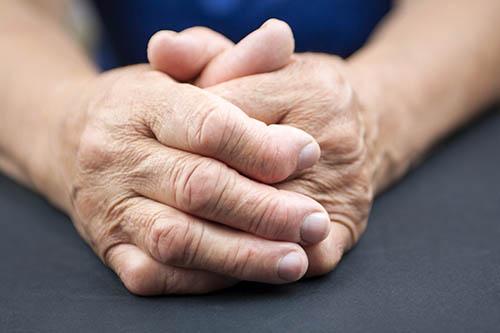 Microscopic colitis a risk factor for rheumatoid arthritis