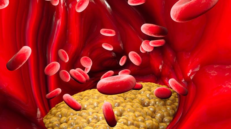 High TG/HDL-C variability tied to diabetes risk