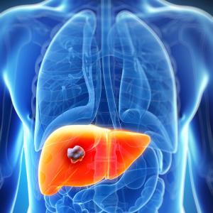 Serum S-adenosylhomocysteine linked to HCC survival