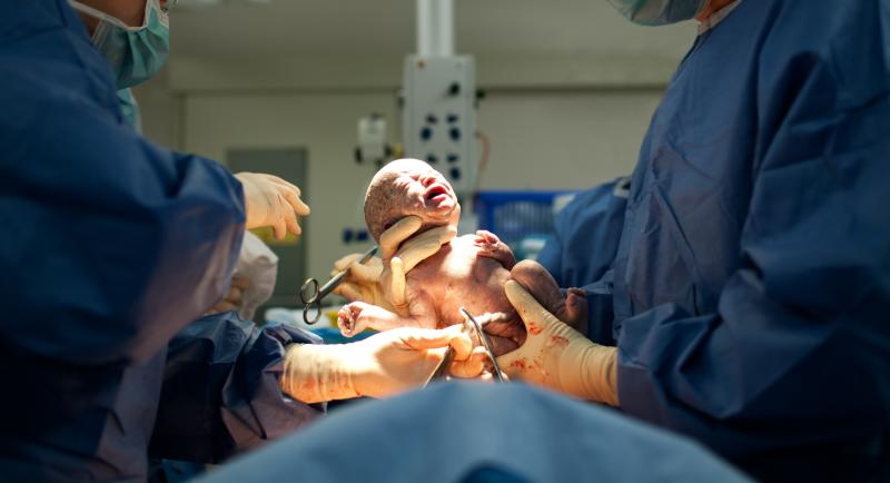 How capable are SG obstetricians in performing operative vaginal delivery?