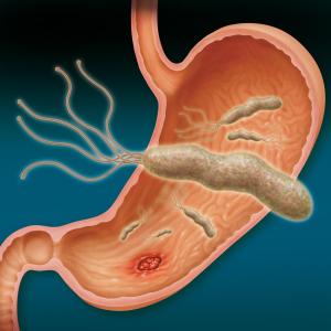 Vonoprazan-based triple therapy knocks out resistant H. pylori infection