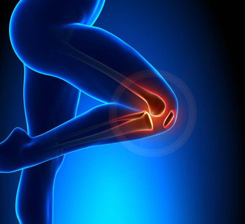 Bisphosphonates pose risk of atypical femur fracture