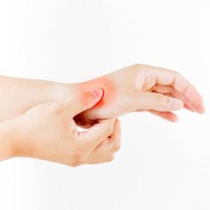 Carpal tunnel syndrome with diabetic polyneuropathy weakens hand dexterity in T2D