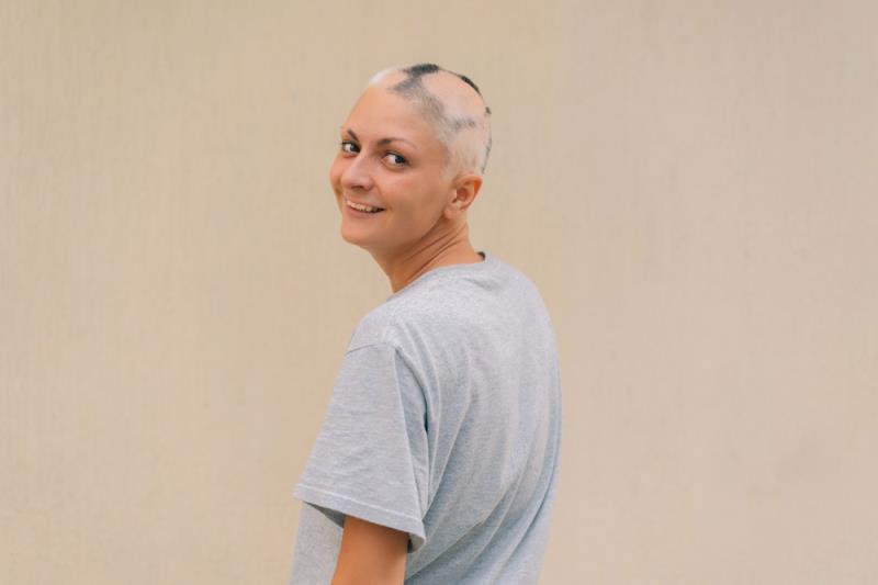 Dual JAK3/TEC inhibition may induce hair regrowth in alopecia areata (AA), an autoimmune disorder characterized by nonscarrin