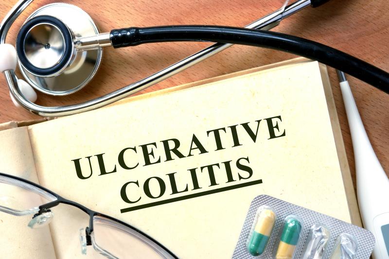 Tofacitinib effective in ulcerative colitis, but higher doses lead to adverse events