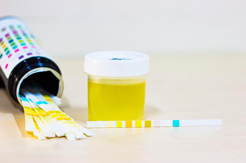 Iptacopan safe, effective in patients with C3G