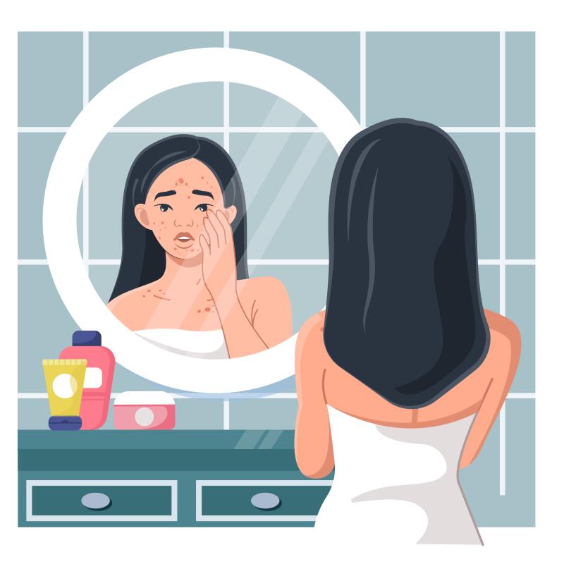 A large cohort study suggests that for patients with acne who received an isotretinoin treatment course, the cumulative dosag