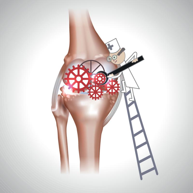 Young age, osteomyelitis, pyogenic bacterial isolation predict sequelae in septic arthritis