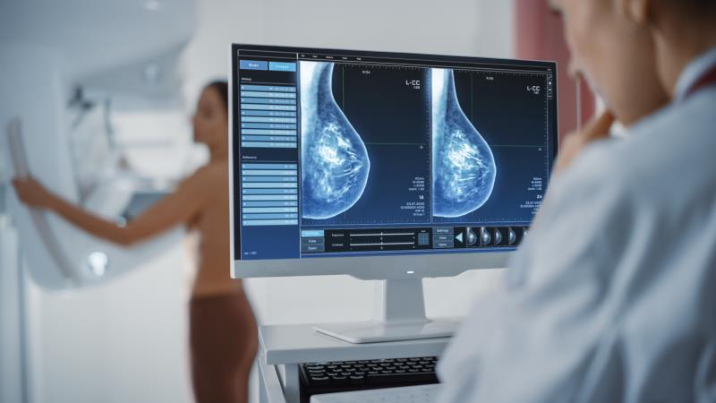 Can very low-risk breast cancer patients be spared from postop radiotherapy?