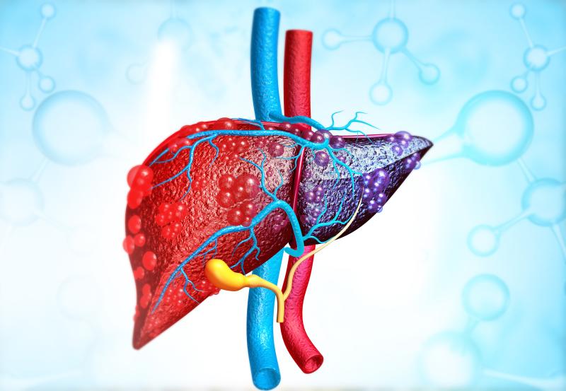 Noninvasive MRE accurately stages liver fibrosis in NAFLD
