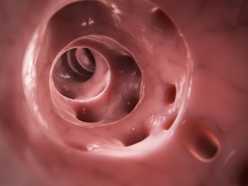 Men and women who move their bowels at least two times daily are at higher risk of developing subsequent diverticulitis, a st