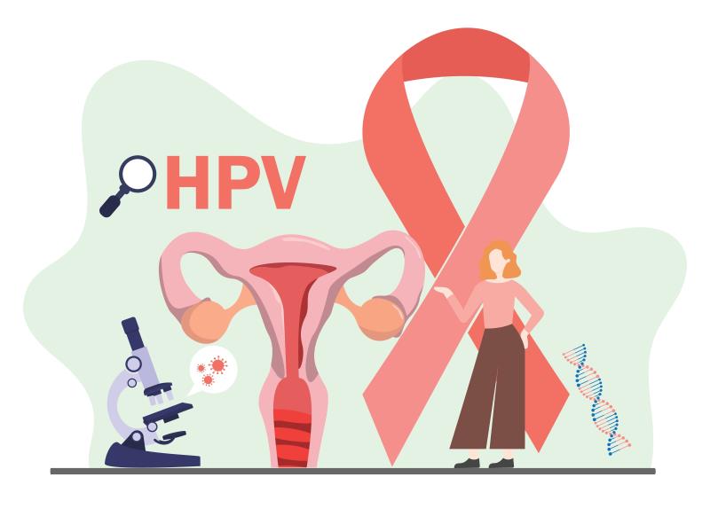 HPV self-sampling with isothermal amplification detection may become part of cervical cancer screening