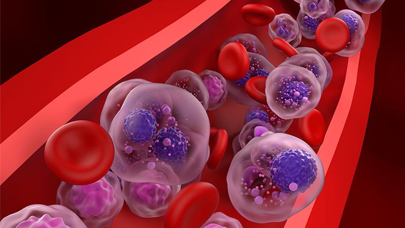 Fludarabine, melphalan, and total marrow irradiation (TMI) 900 cGy may be utilized as conditioning for allogeneic stem cell t