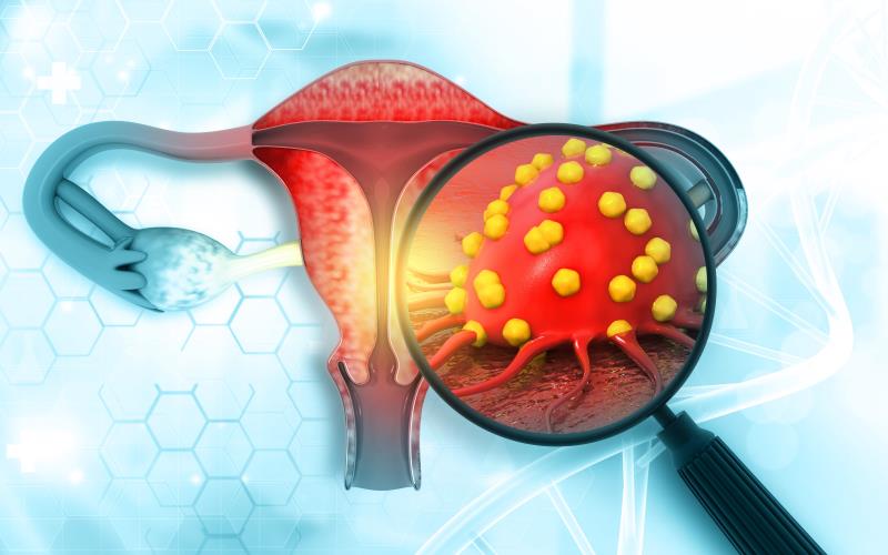 Enzalutamide demonstrates modest activity in granulosa cell ovarian tumours