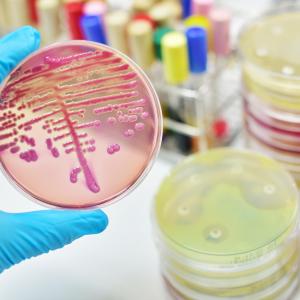 More prostate cancers caught with transperineal vs transrectal biopsy