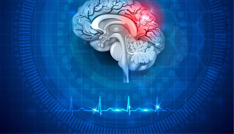 Optimising management of stroke and bleeding
in atrial fibrillation