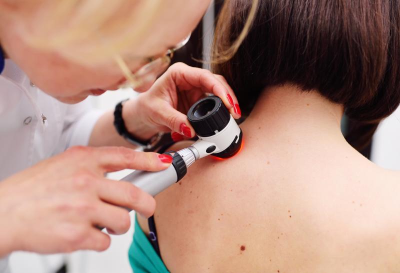 Second primary melanoma tied to better survival than single primary lesion