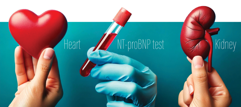 <p style="margin: 0cm;"><span>Elevated N-terminal pro&ndash;B-type natriuretic peptide (NT-proBNP) levels independently predi
