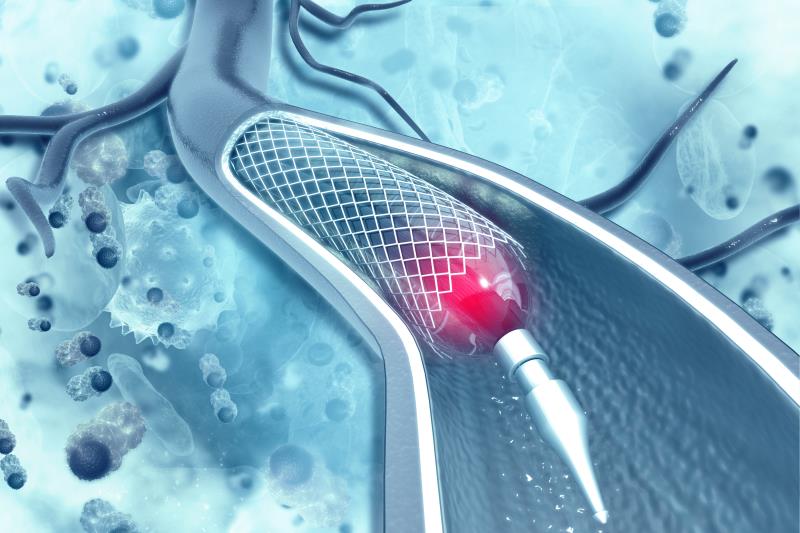 In patients treated with drug-eluting stents (DES) for <a href="https://specialty.mims.com/acute%20coronary%20syndromes%20w_o