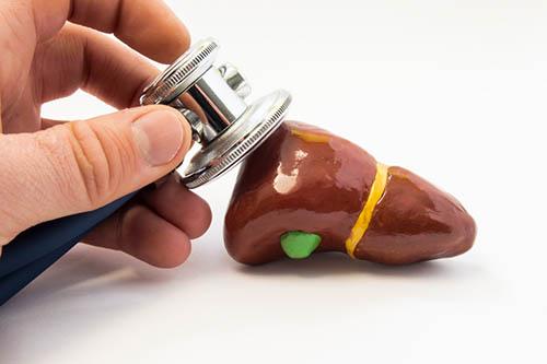 Certain HCC patients on atezolizumab–bevacizumab combo at risk of variceal bleeding