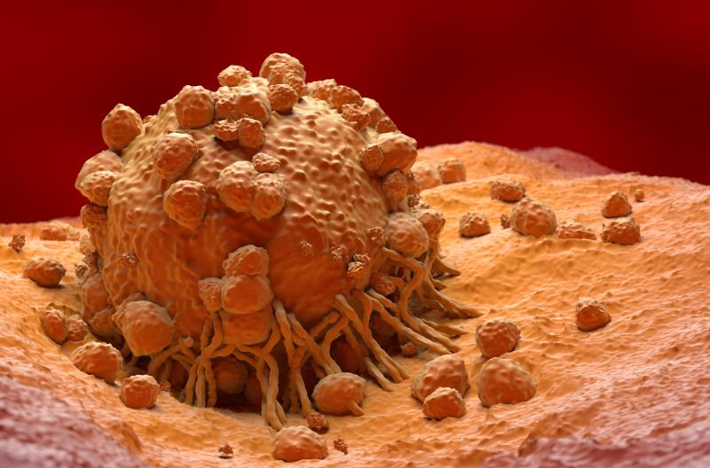 Melanoma diagnoses in 2020 tend to have thicker, more advanced tumours