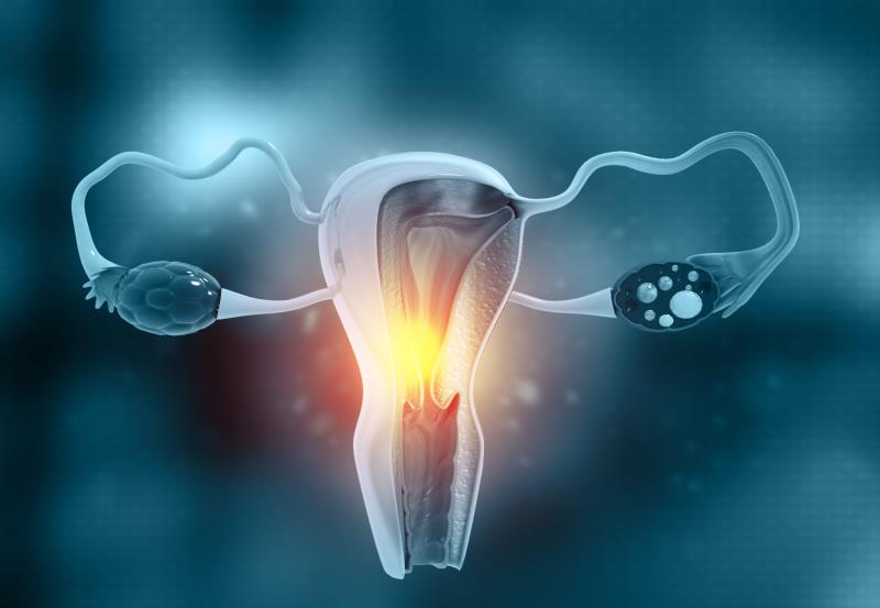 The presence of <a href="https://specialty.mims.com/endometriosis/treatment" target="_blank">endometriosis</a> does not appea