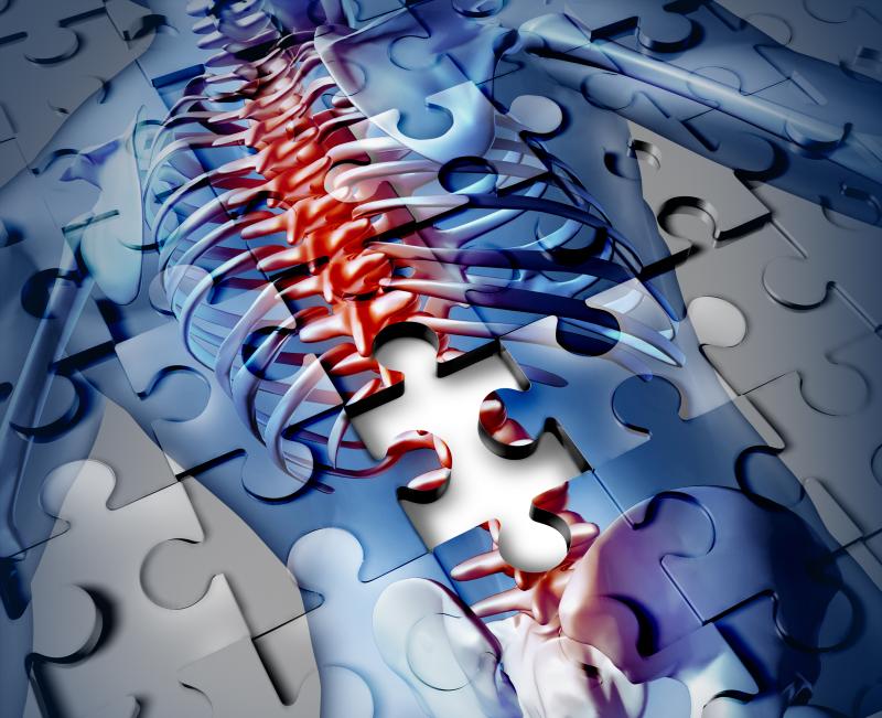 Low BMD predicts death, infections in stroke patients