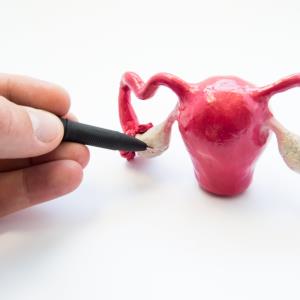 Hyperthermic intraperitoneal chemotherapy beneficial in recurrent ovarian cancer