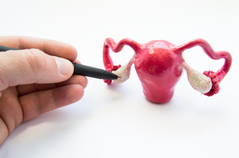 Hyperthermic intraperitoneal chemotherapy beneficial in recurrent ovarian cancer