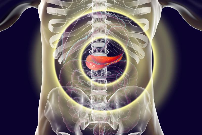 Robotic pancreatoduodenectomy safe, feasible in select SG patients