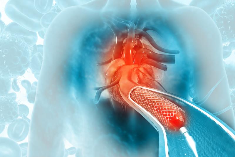 Paclitaxel-coated devices may prevent death in endovascular revascularization