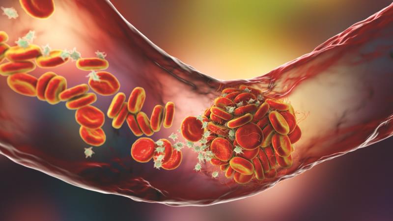 <p><span style="text-align: justify;">Chinese patients with <a href="https://specialty.mims.com/pancreatic%20cancer/treatment