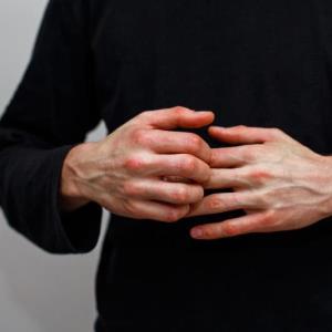 Một số yếu tố có thể hạn chế hiệu quả điều trị bệnh vảy nến của các thuốc sinh học