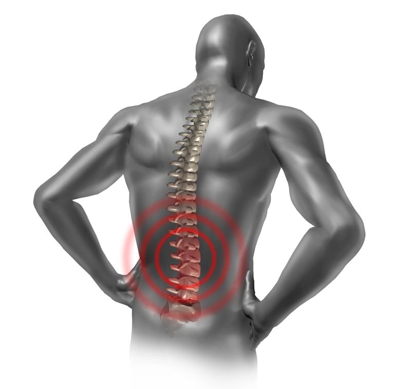Early etanercept treatment of no benefit in suspected nonradiographic axial SpA