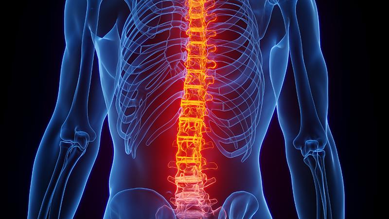 Tofacitinib demonstrates greater efficacy than placebo at week 12 in patients with <a href="https://www.mims.com/specialty/an