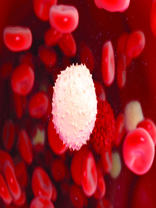 Chronic Myeloid Leukemia