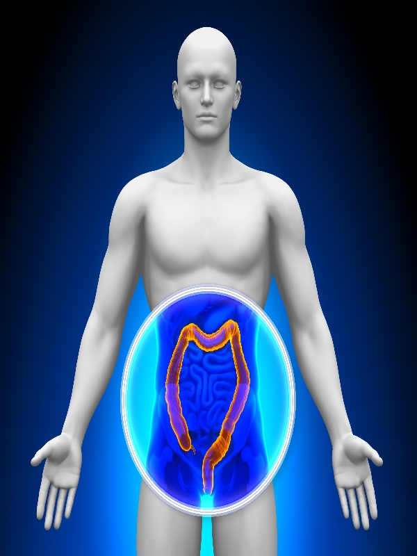 Clostridioides difficile Infection